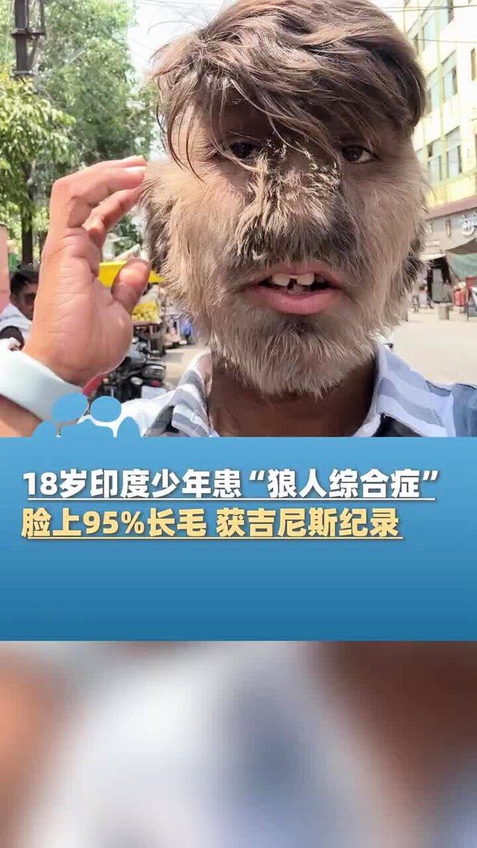 人妻逼逼网的相关介绍